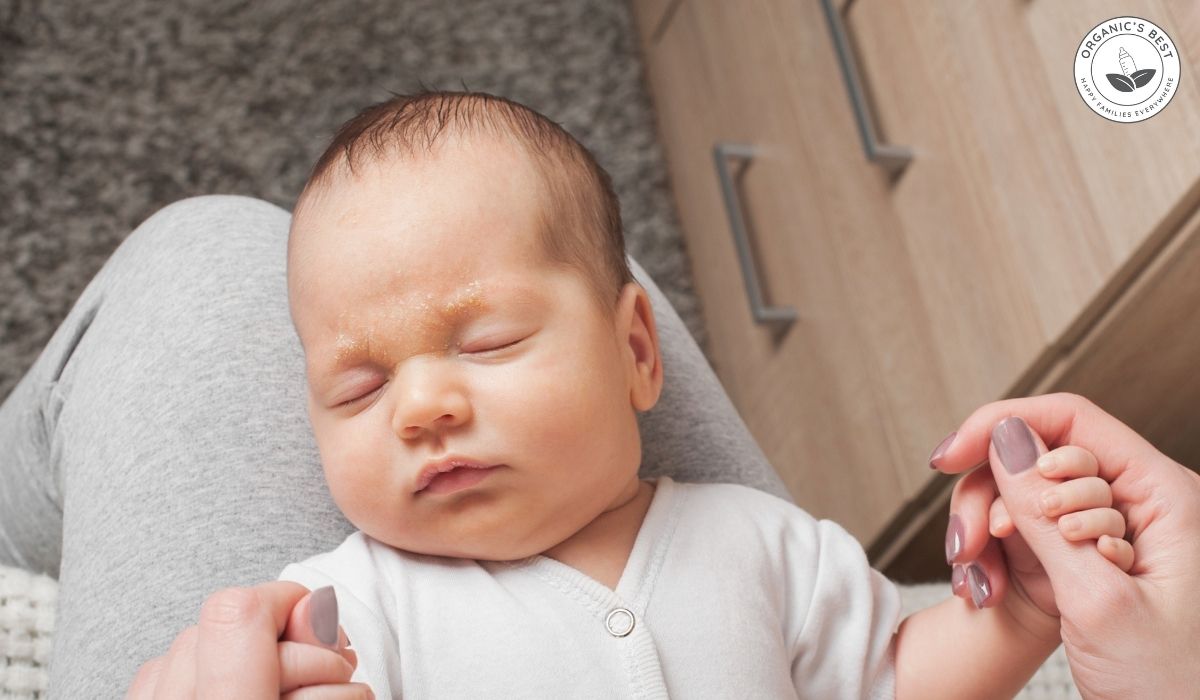 Infant Eczema - Possible Causes & Treatments